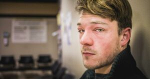 Man sitting in ER at hospital waiting for help for his hives all over his face.