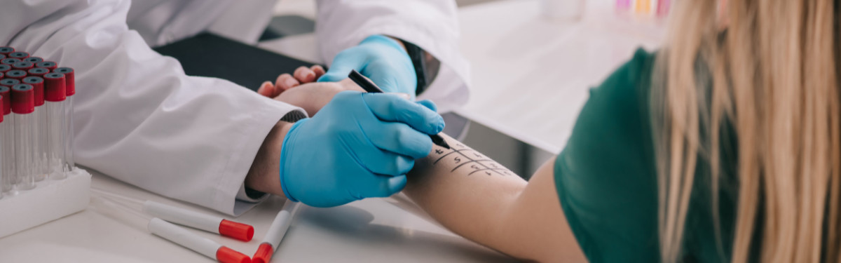 cropped view of doctor in white coat and medical gloves holding marker pen near marked female hand. Doctor is testing for latex allergy and other sensitivities.