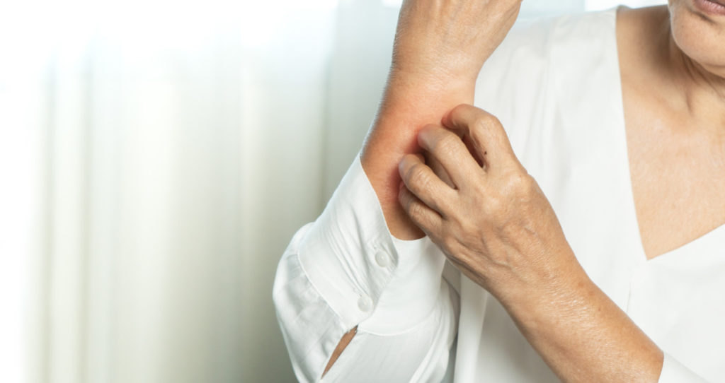 Photo of woman scratching her arm, wondering if she has eczema.